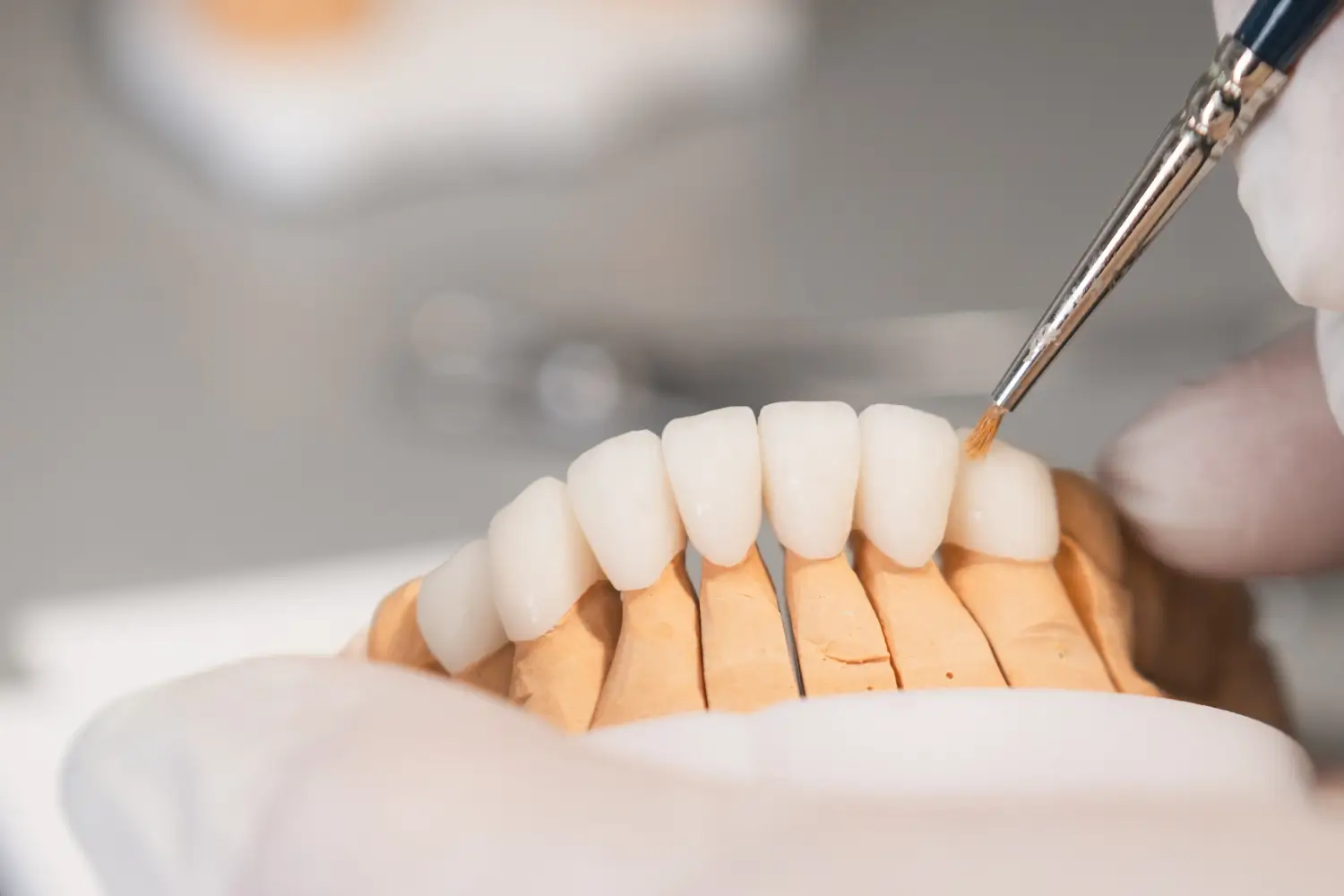 Korony i mosty protetyczne